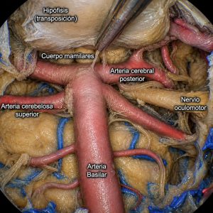 Curso Base de Cráneo 360º Parte 3